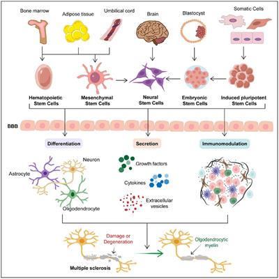 Stem cell therapies: a new era in the treatment of multiple sclerosis